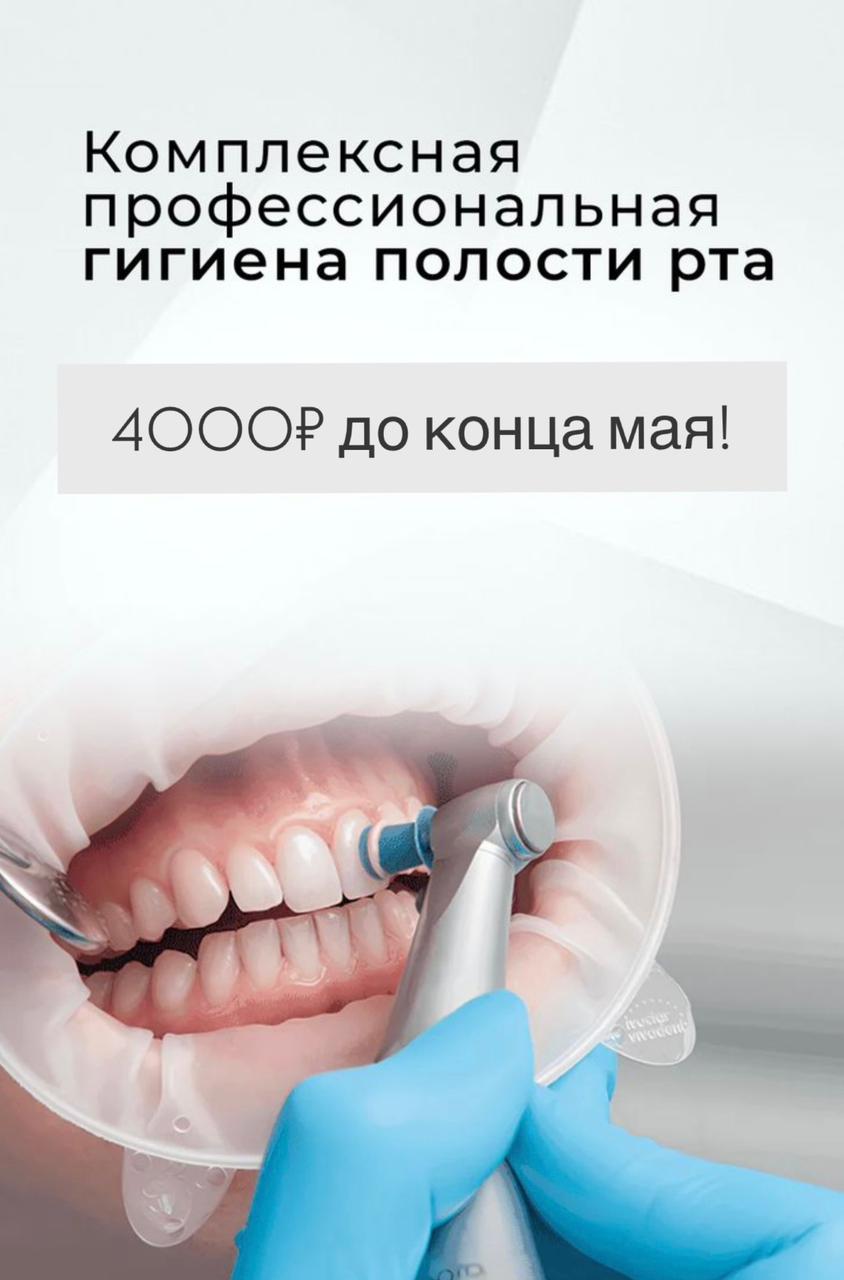 Все на 4